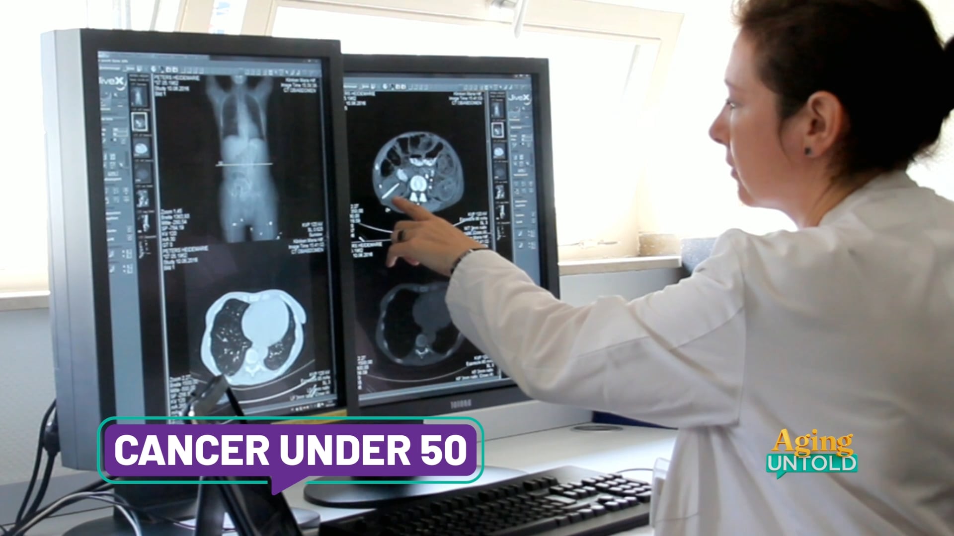 Cancer Diagnoses Rising Among Adults Under 65, Report from Tallahassee Highlights Trend
