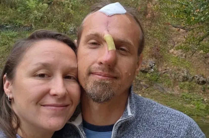 Georgia Man Suffers Severe Facial Injuries Breaking Up Fight Between Family Dogs